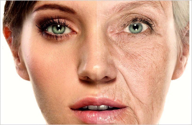 Типы старения кожи лица