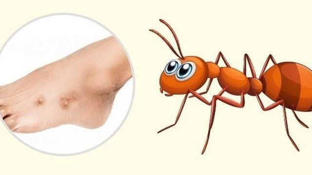 Аллергия на домашних муравьев